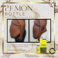 lemon bottle lemonbottle pine bottle lipolab lipovela for Fat Dissolve