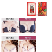 Line body 50ml dermal filler injection
